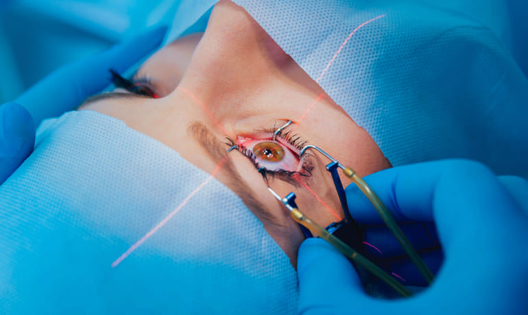 Cirugía Láser Refractiva (Lasik y PRK)